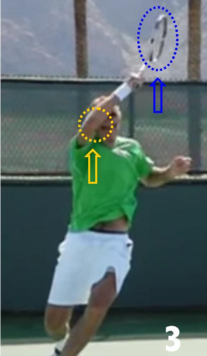 DP 3