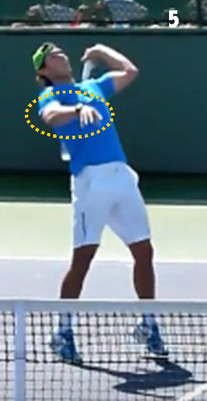 Nadal Smash 5